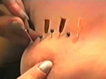 Girl gets punished with needles